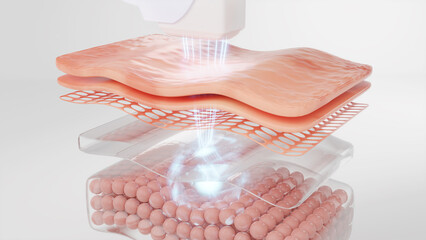 Medical Lasers Market Growth Trajectory, Key Drivers And Trends