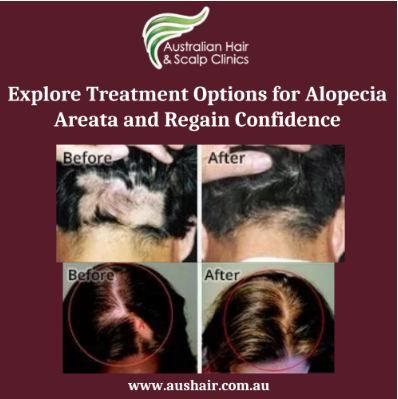 Understand Androgenetic Alopecia: Causes and Treatments 