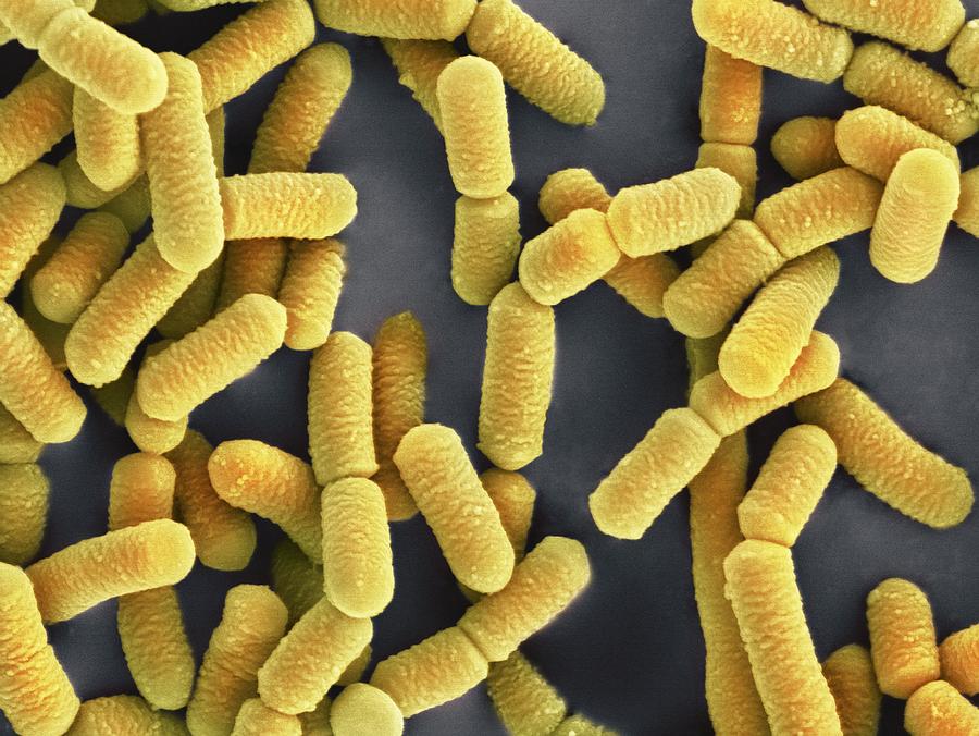 Importance of Lactobacillus Acidophilus Probiotics