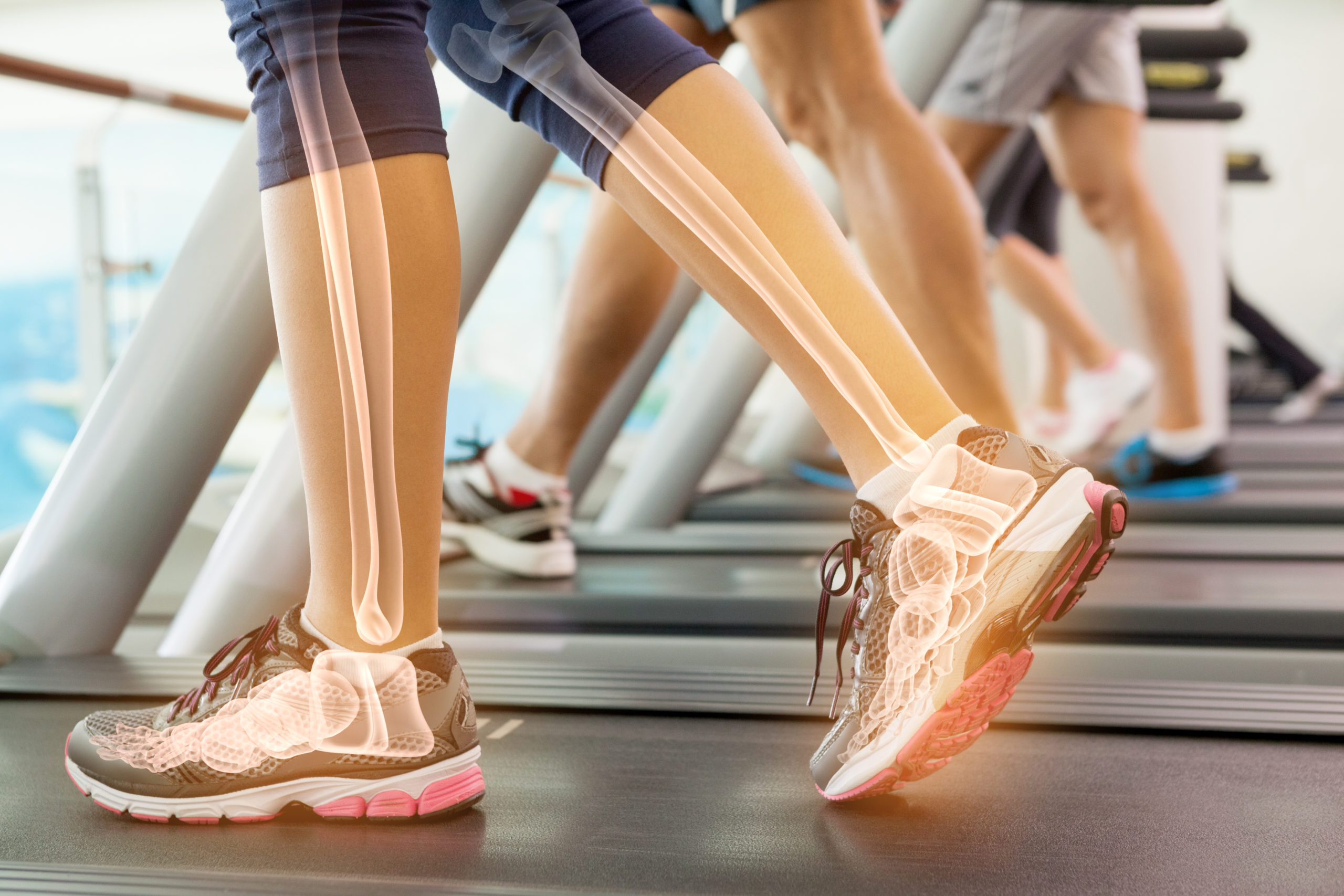 Glucosamine and Chondroitin - The Foundation for Joint Support