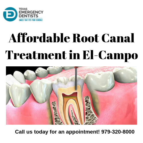 Affordable Root Canal Treatment in El-Campo