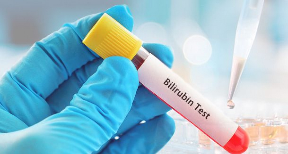 Bilirubin Blood Test Market Size, Industry Growth, Share, Opportunities, Emerging Technologies 2030