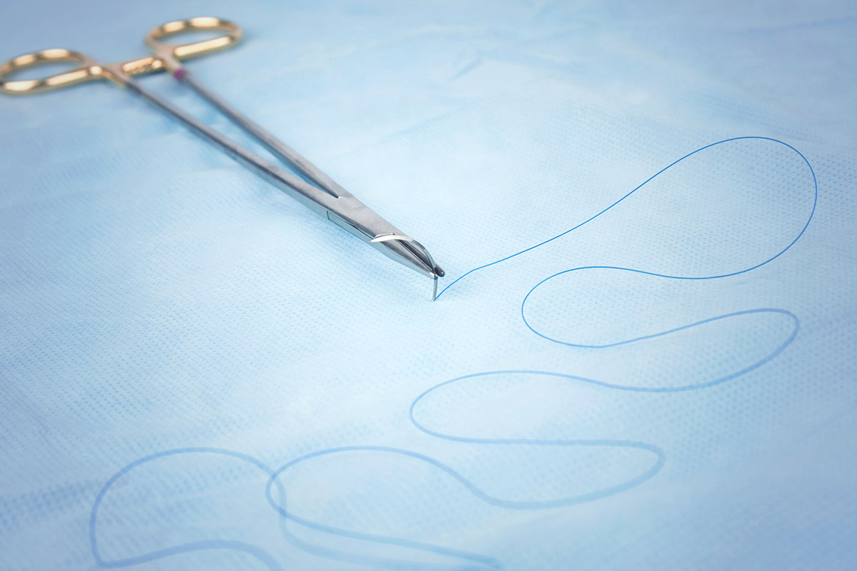 Hospital Sutures Market Size, Share Report 2028