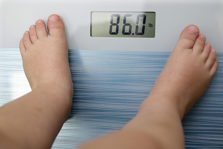 What are the Causes, Complications, and Treatment of Obesity?