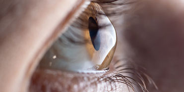 Common cornea diseases and disorders