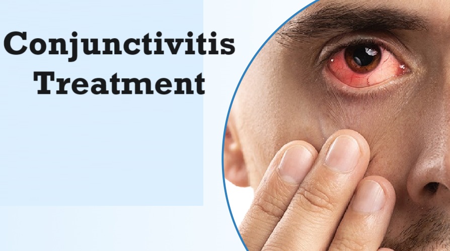 Conjunctivitis Treatment Market Size, In-depth Analysis Report and Global Forecast to 2032