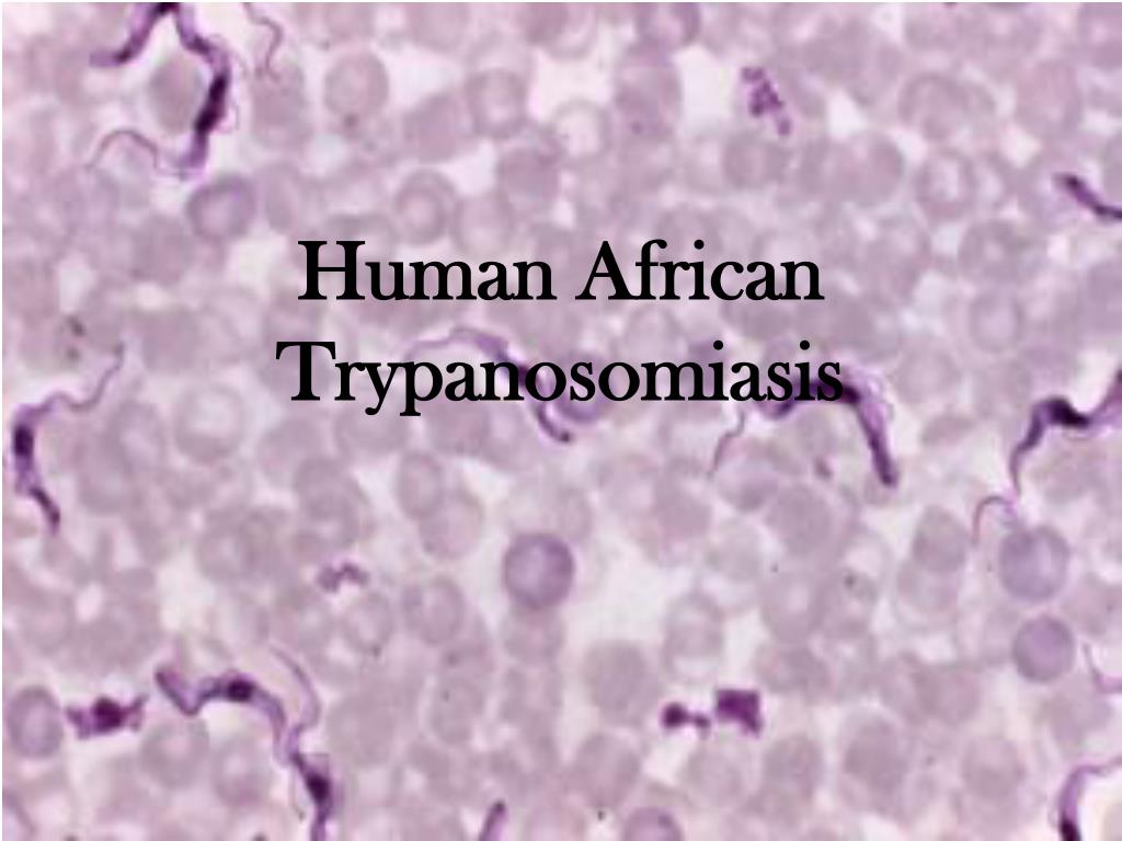 Global Human African Trypanosomiasis Market 2023 - Top Key Players Analysis Report Till 2032