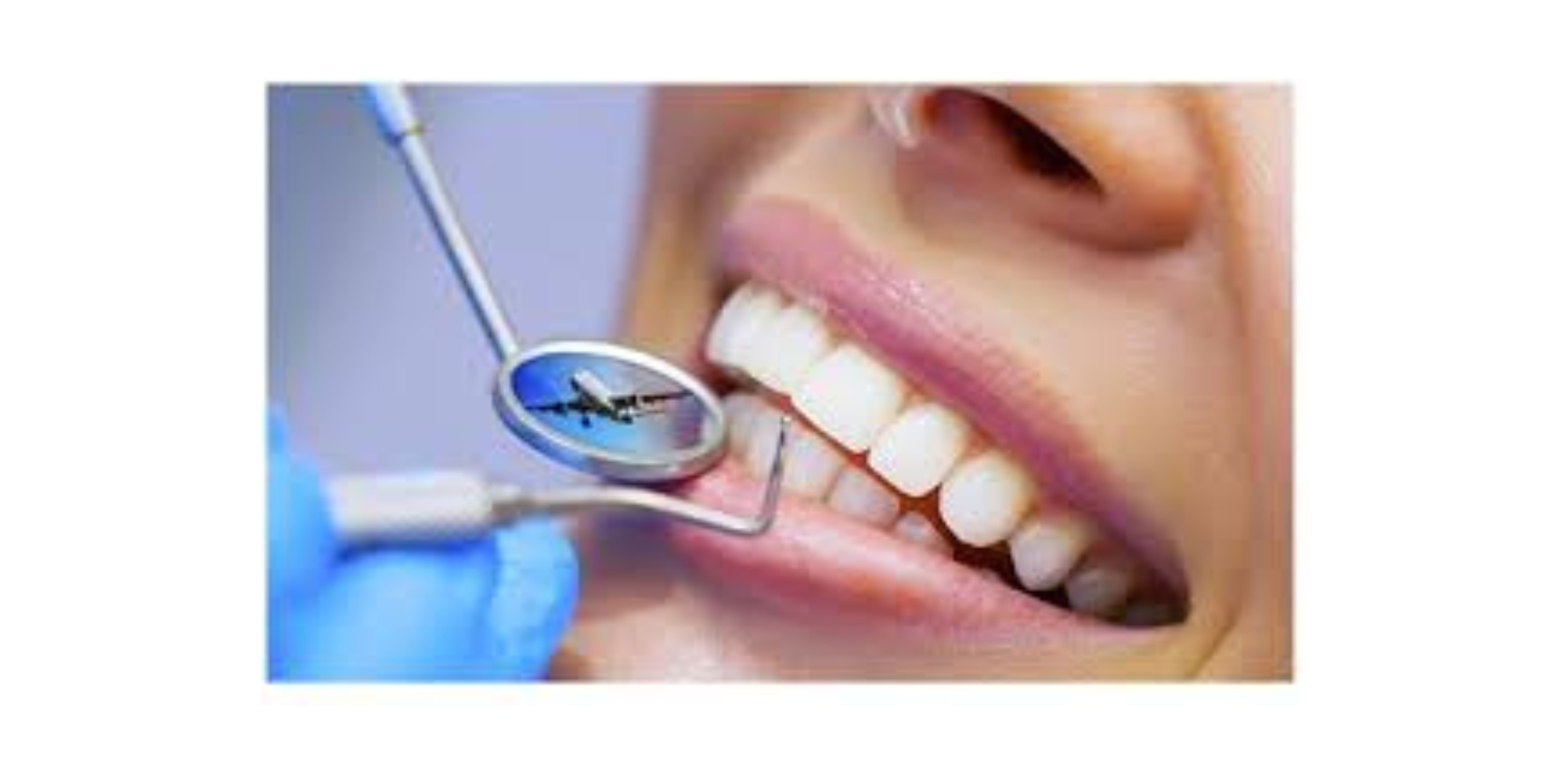 Why to Visit Only the Best Dental Clinic in Your City?