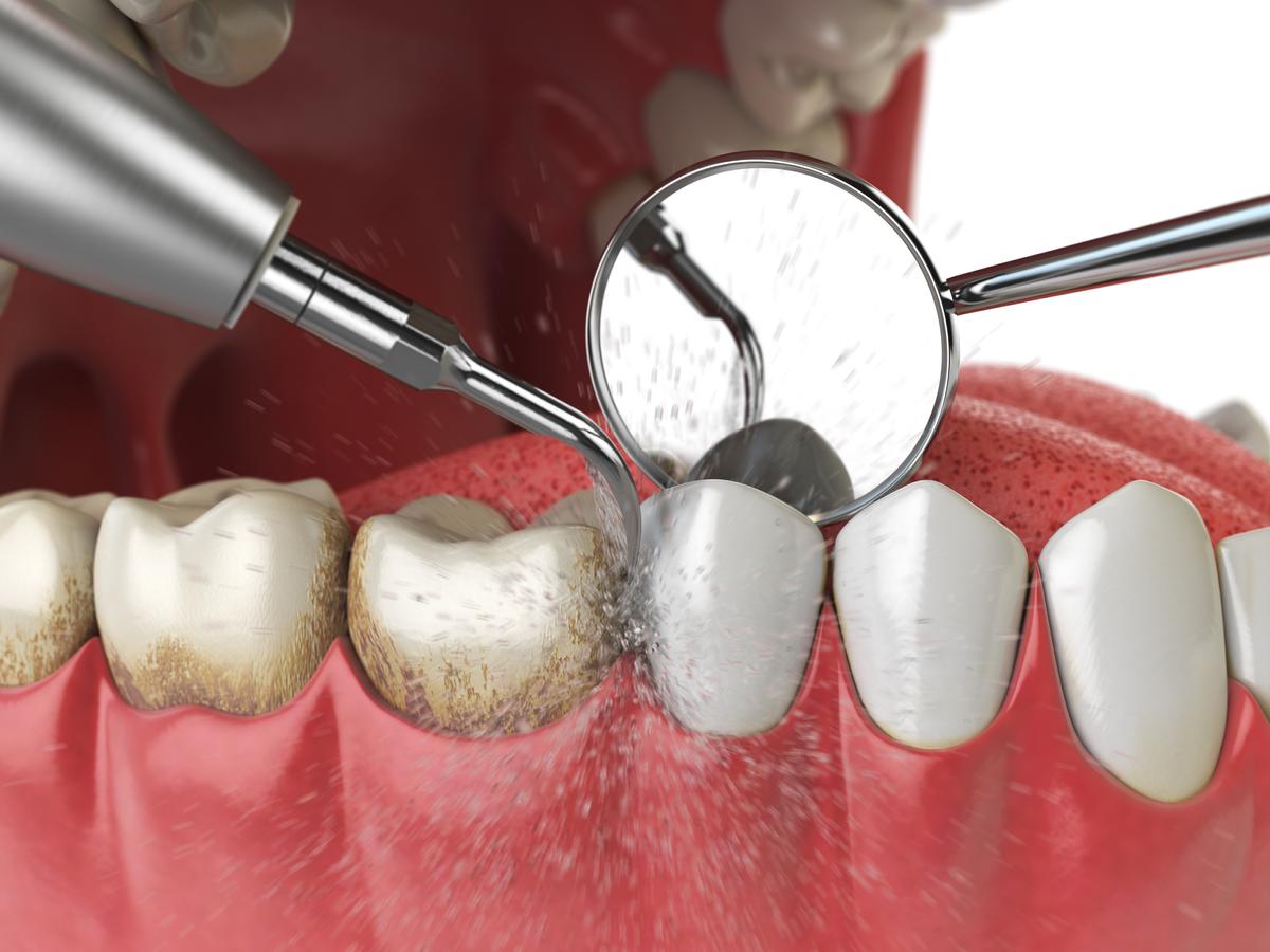 The Connection Between Oral Health and Overall Health