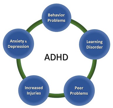 Know about the Best Natural Supplements for ADHD