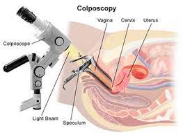 Visualizing Women's Health: The Evolving Landscape of Photocolposcopes Market