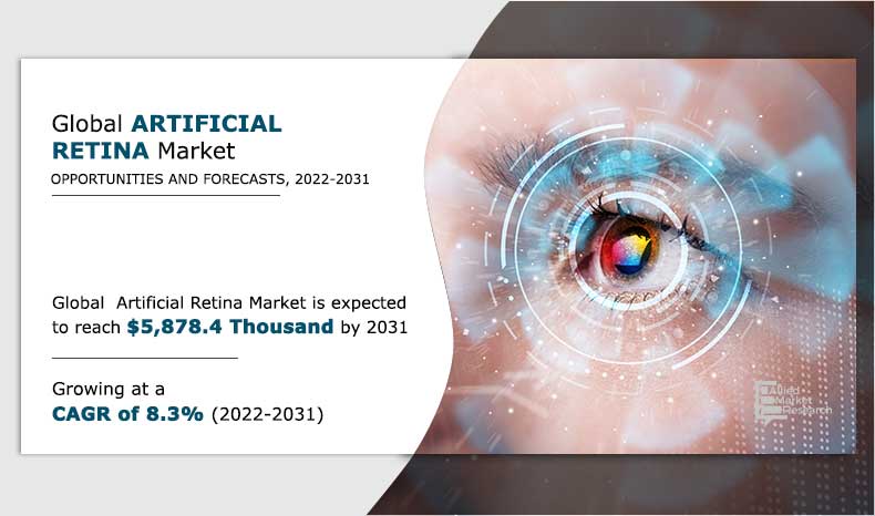 Vision Revitalized: Exploring Breakthroughs in the Artificial Retina Market