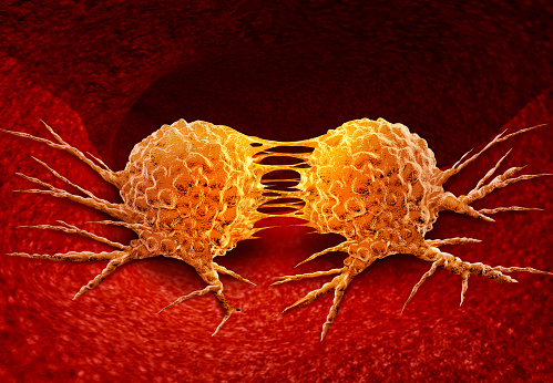 Metastatic Melanoma Therapeutics: A Guide to Current and Emerging Treatment Options 