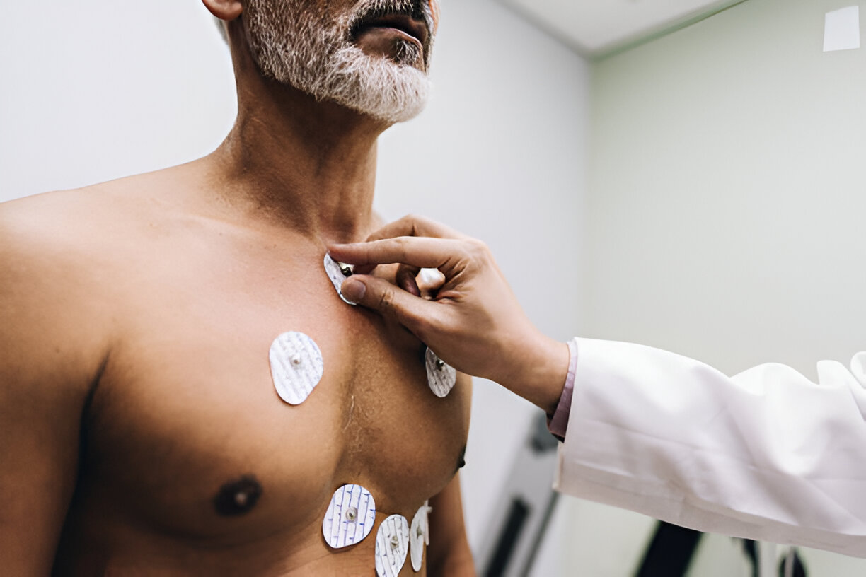 How Does an ECG Work? Understanding This Essential Heart Test