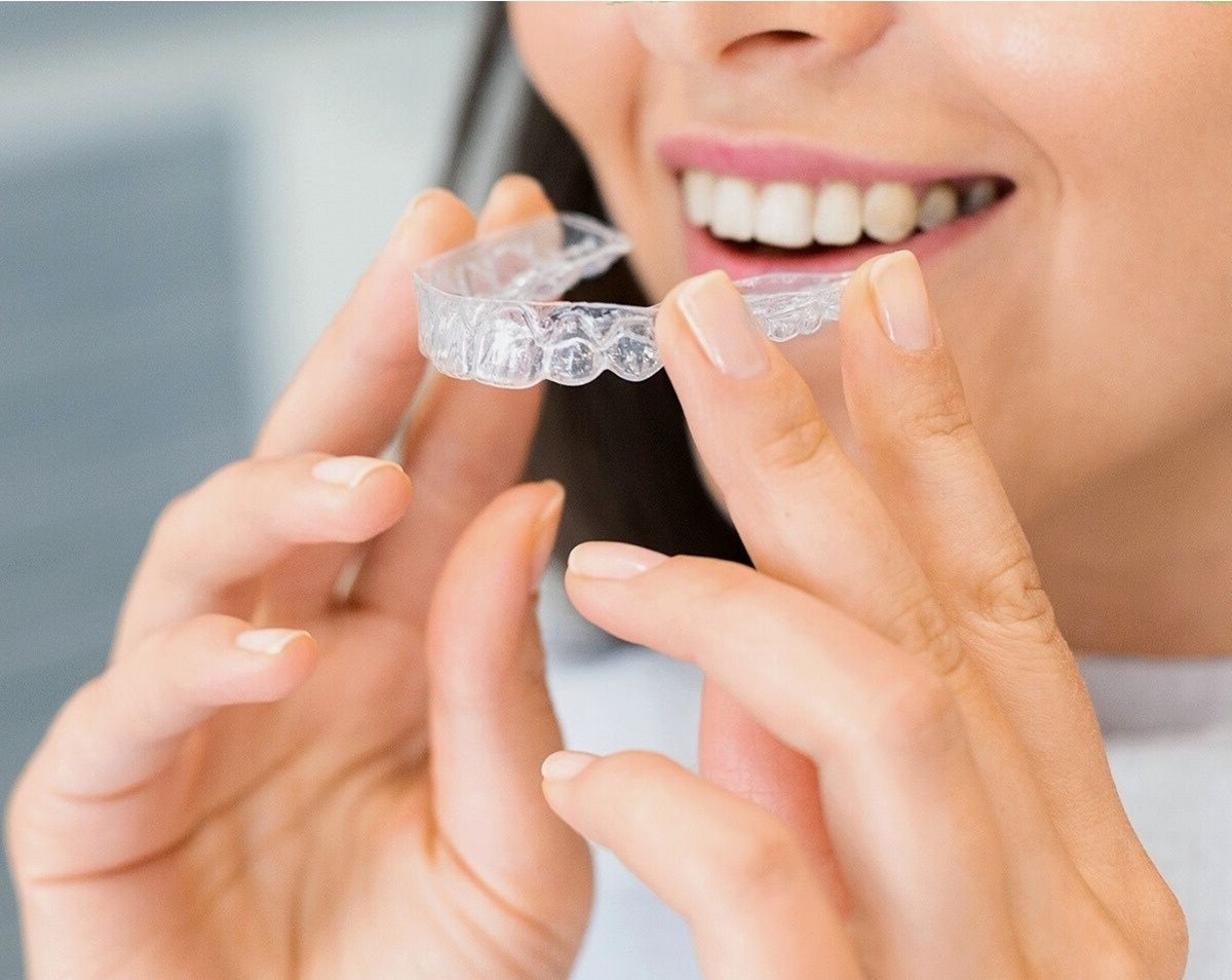 How Long Do Porcelain Veneers in Preston Last?