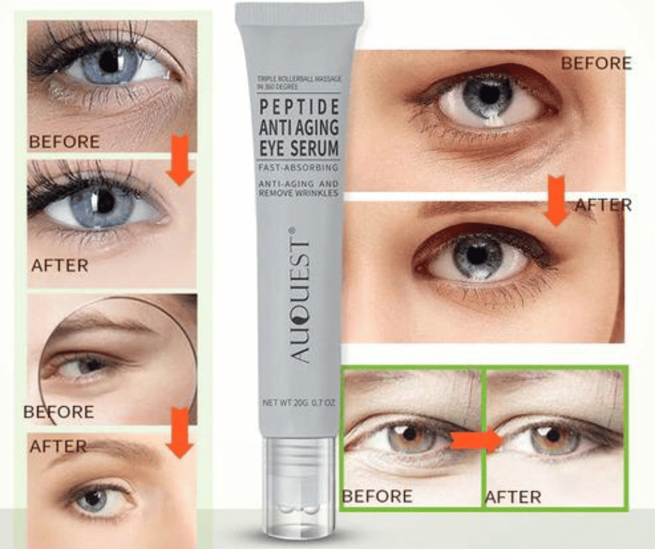 The Definitive Guide to Selecting the Ideal Painless Eyebrow Epilator for Impeccable Brows