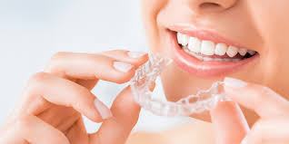 Smile Transformations: Before and After with Westchester Braces