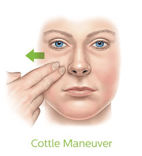 Nasal Implant Surgery in Fort Myers: Restoring Breathing and Confidence