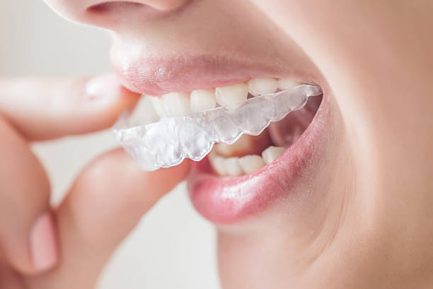 Transform Your Smile with Invisalign in Five Forks SC: A Clear Path to Confidence