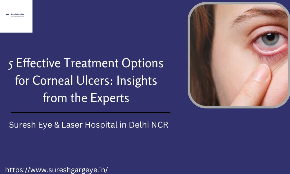 5 Effective Treatment Options for Corneal Ulcers: Insights from the Experts