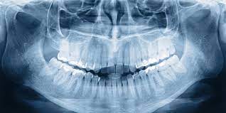 Dental X-Ray  Market Size, Share Analysis, Key Companies, and Forecast To 2030	