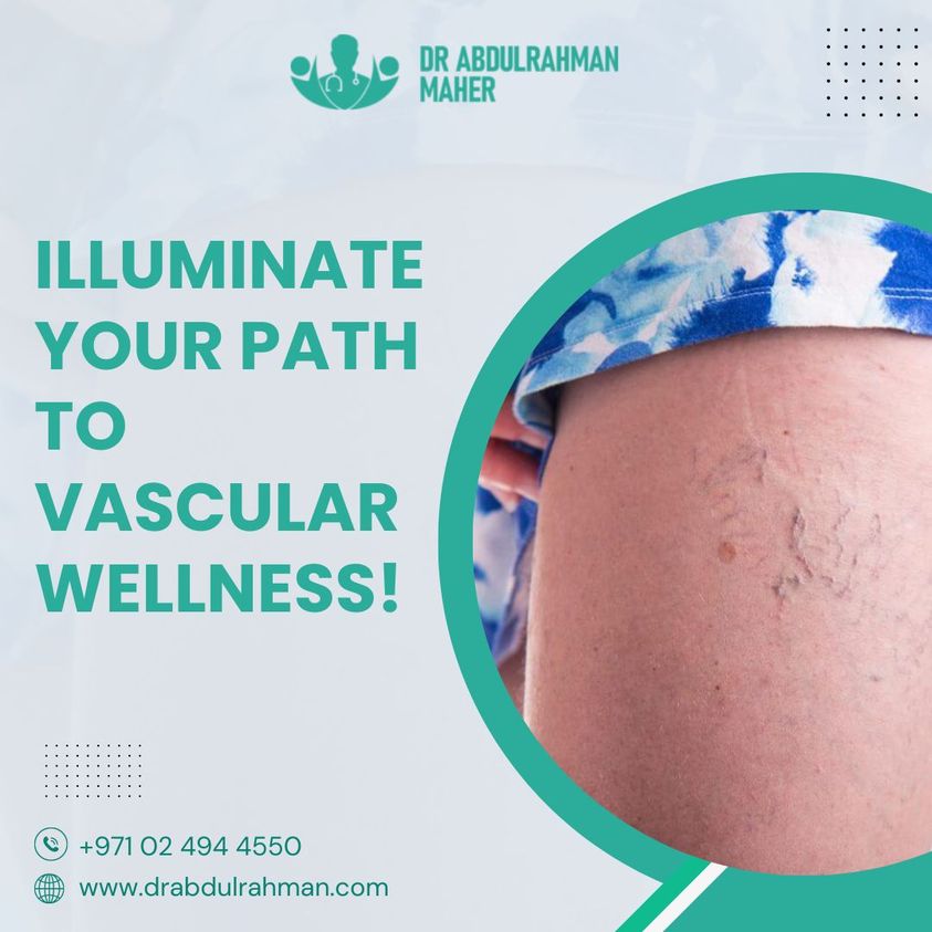 Finding the Best Vascular Surgeon in Abu Dhabi for Diabetic Foot Care