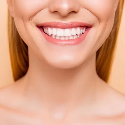 The Hollywood Smile Blueprint: Tips and Techniques