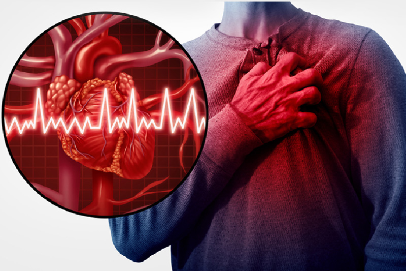 Comprehensive Analysis and Forecasting of the Global Myocardial Infarction Market: Trends, Opportunities, and Growth Prospects