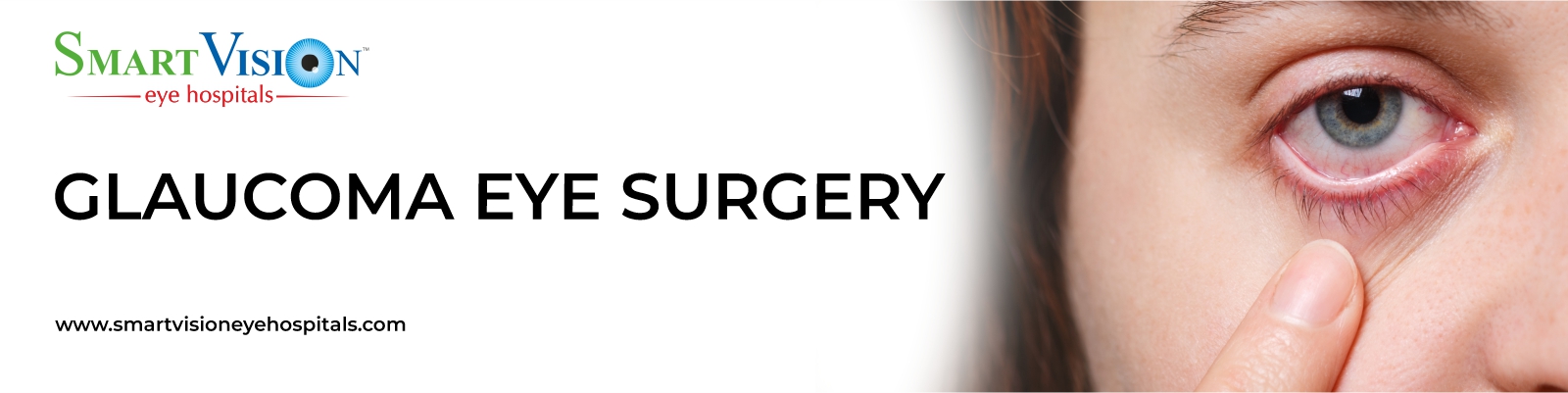 Best Hospital for Glaucoma Treatment in Hyderabad