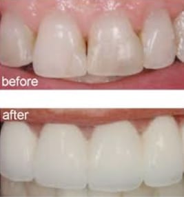 The Comprehensive Guide to Sidcup Dental Clinic: Your Hub for Oral Health