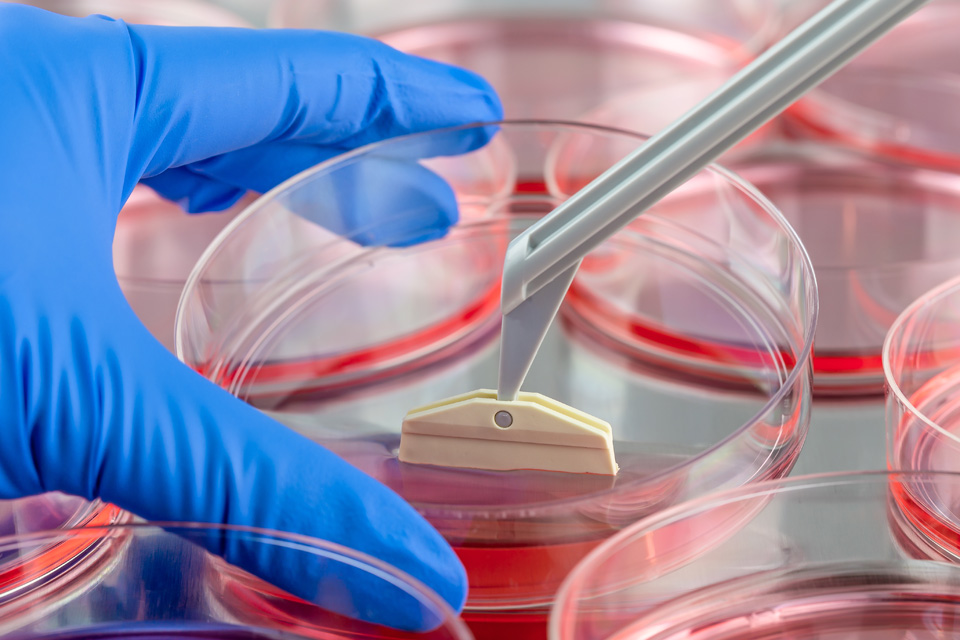 Stem Cell Therapy Is Fasted Growing Segment Fueling The Growth Of Tissue And Organ Transplantation Market 