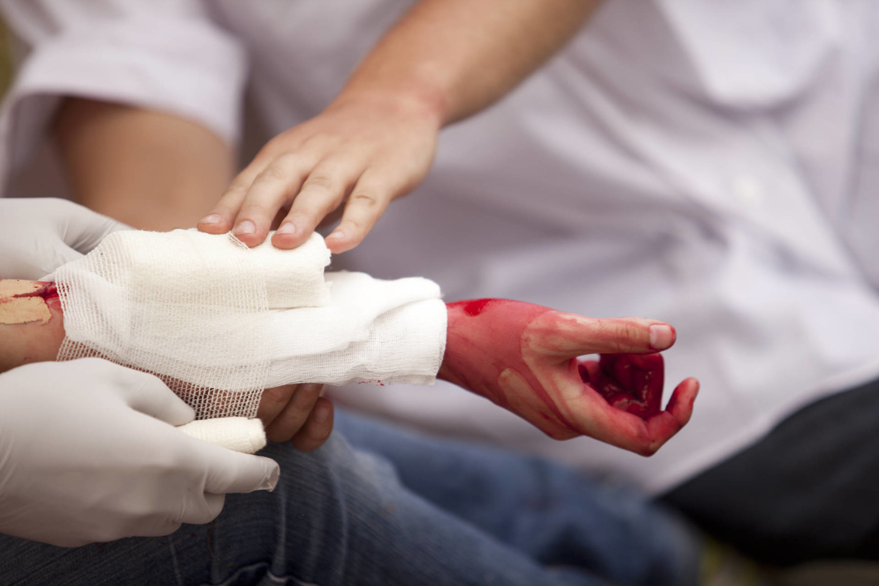 Bleeding Control Kit Industry: Keeping Life-Threatening Bleeding Under Control With Global BCK