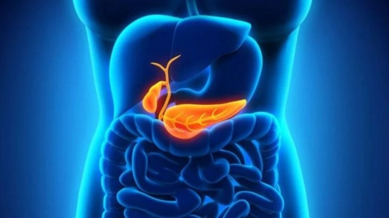 Primary Sclerosing Cholangitis: A Rare but Serious Liver Disease 