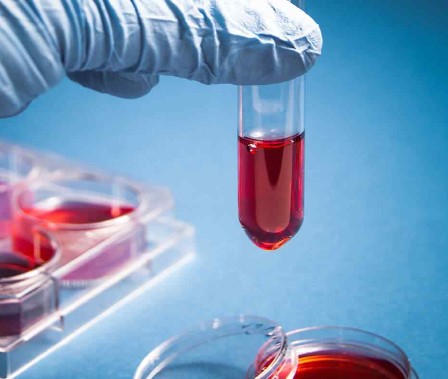 Navigating the Complex World of Formulation Product Development