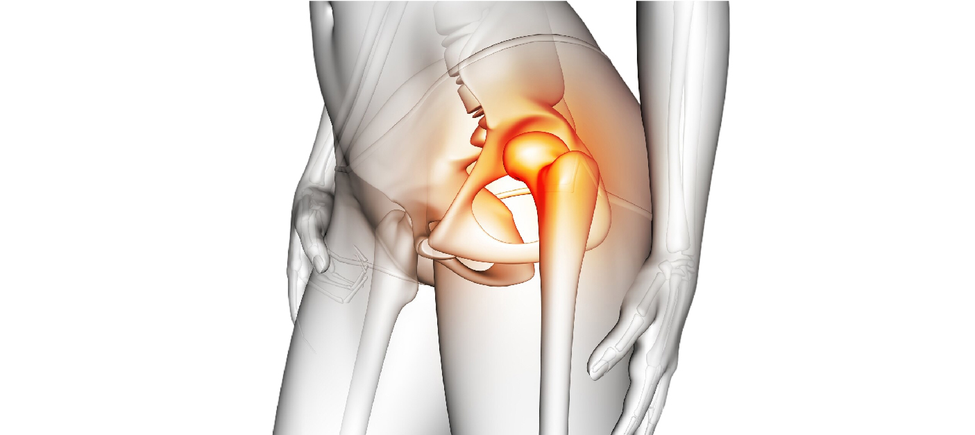 About Best Hip Replacement in Bhopal