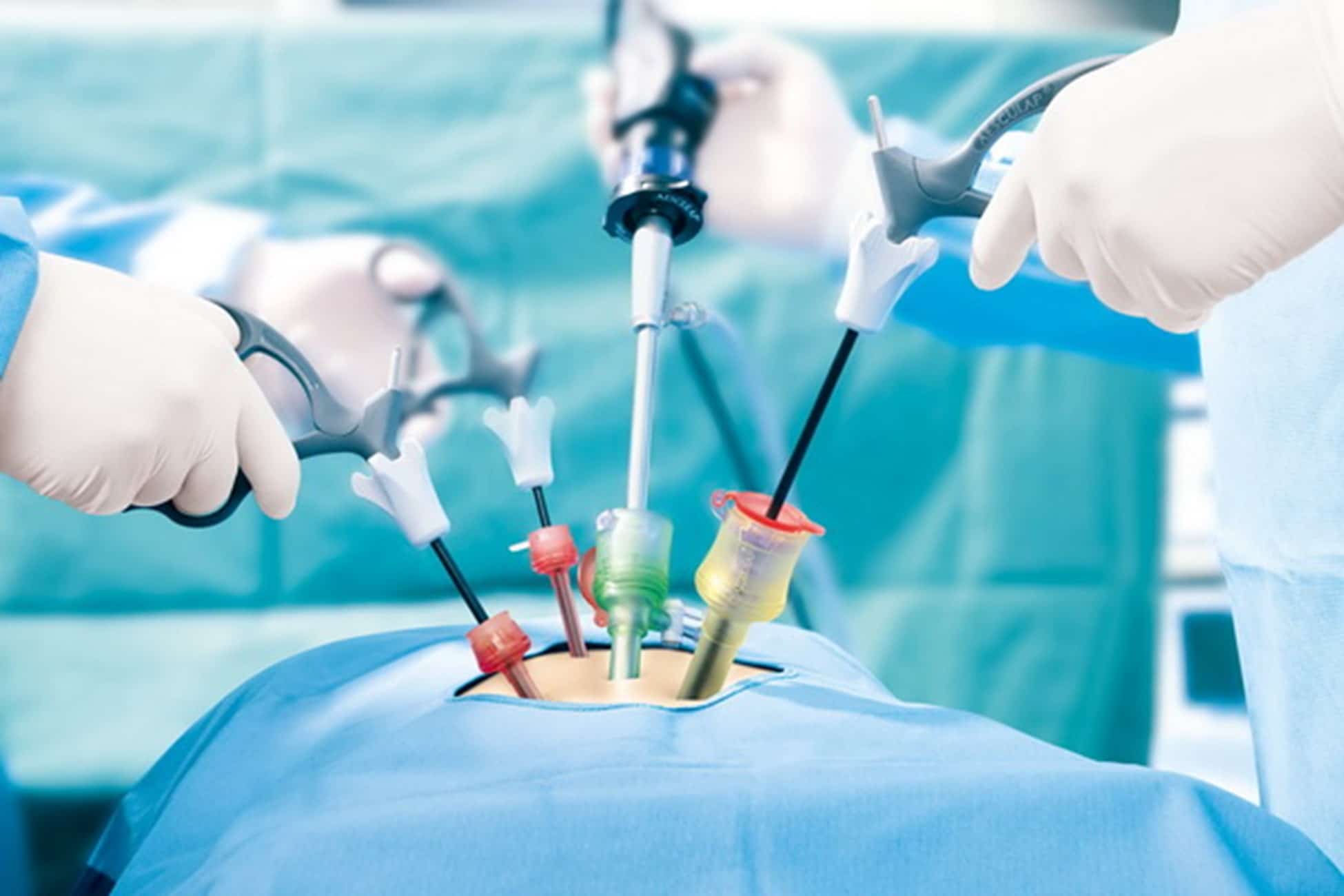 The Best Laparoscopic Surgeon in Bhopal