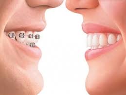 10 HIDDEN BENEFITS OF TEETH WHITENING