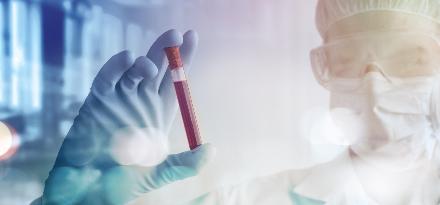 Liquid Biopsy Market Is Estimated To Witness High Growth Owing To Emergence Of Non-Invasive Early Cancer Diagnosis Opportunity