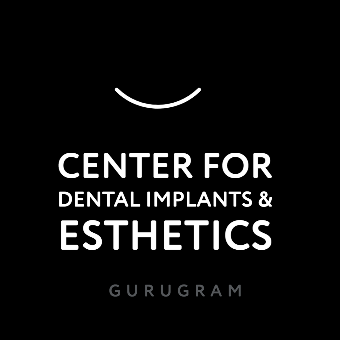 Center for Dental Implants & Esthetics: Your Destination for Quality Dental Care
