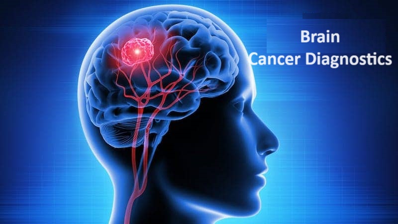 Brain Cancer Diagnostics Market 2023 Major Key Players and Industry Analysis Till 2032