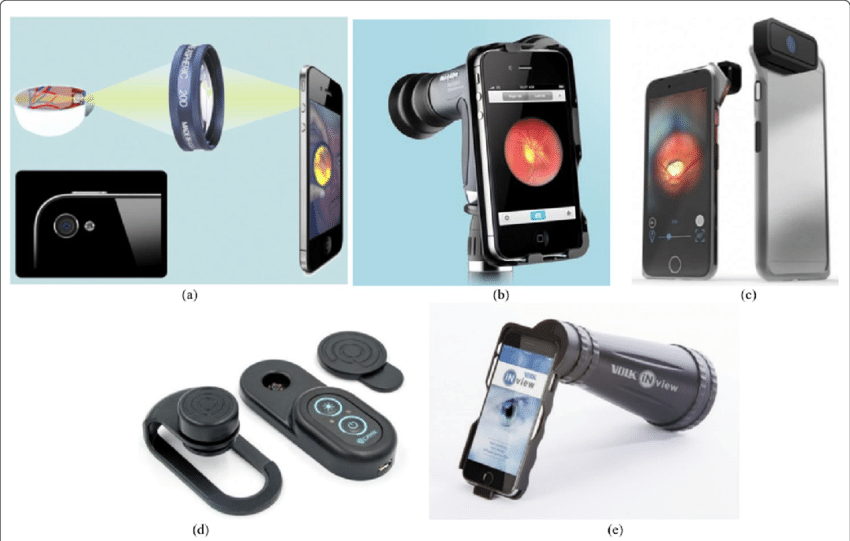 Global Fundus Camera Market Size, Trends & Forecast 2031