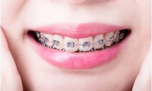 What Makes a Top Orthodontist in Miramar