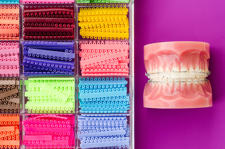 What is considered a normal overbite?