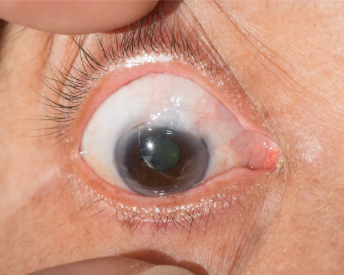 Eye Specialists in Sri Lanka