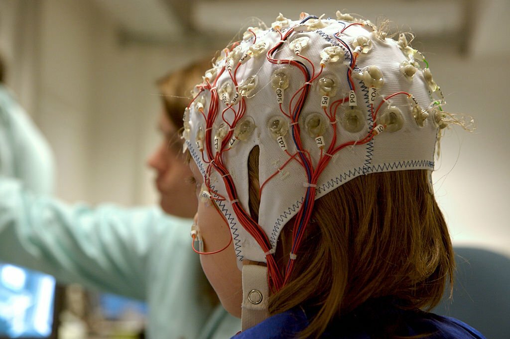 Exploring the Science behind Neurofeedback: A Comprehensive Overview