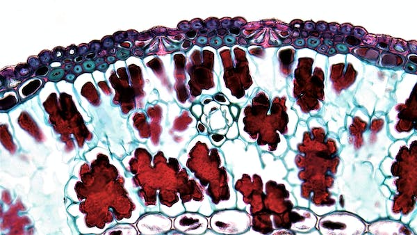 Cell Separation Global Market 2024 - By Size, Share, Technological Advancement, Competitive Landscape Forecast To 2033