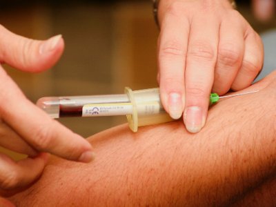 The Myelodysplastic Syndrome Treatment Market is driven by rising prevalence of hematological malignancies