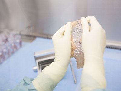 Rise of Bioengineered Artificial Skin Market is Driven by Growing Disfigurement Cases