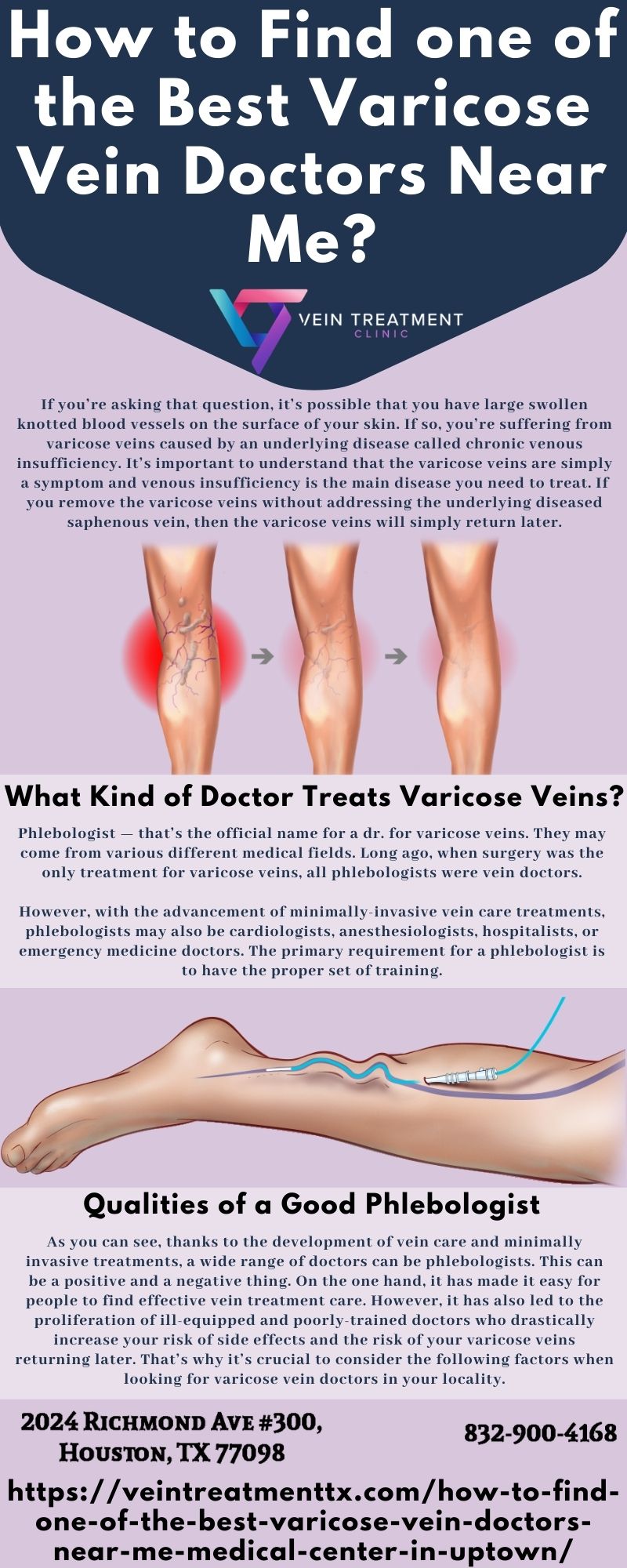 How to Find one of the Best Varicose Vein Doctors Near Me?