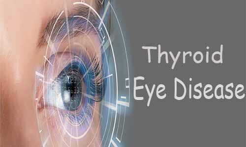 Thyroid Eye Disease Treatments Market Size, Share, Regional Overview and Global Forecast to 2032